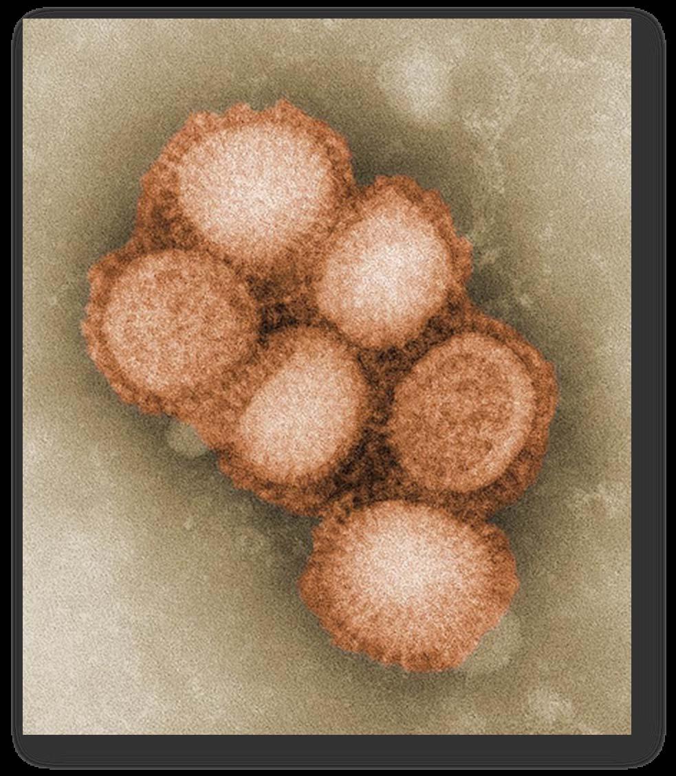 Novel H1N1 Influenza A