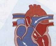 3= ventricular ejection 4= Isovolumetric ventricular relaxation Early Diastole 1= Ventricular filling 2=