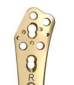 4 Secure plate to bone Instruments 310.430 4.3 mm Drill Bit B G 324.052 3.