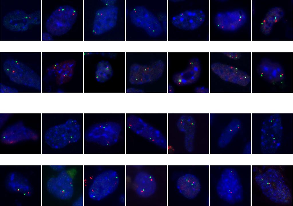 RN FISH (Differentiated mouse ES cells) cvr1 urka Lamp2 171P1Rik Lamp2 cvr1 urka 171P1Rik % nuclei 1 8 6 4 2 shrn: X chromosome painting (Differentiated ES cells) cvr1 urka 171 P1Rik 2 signals 1