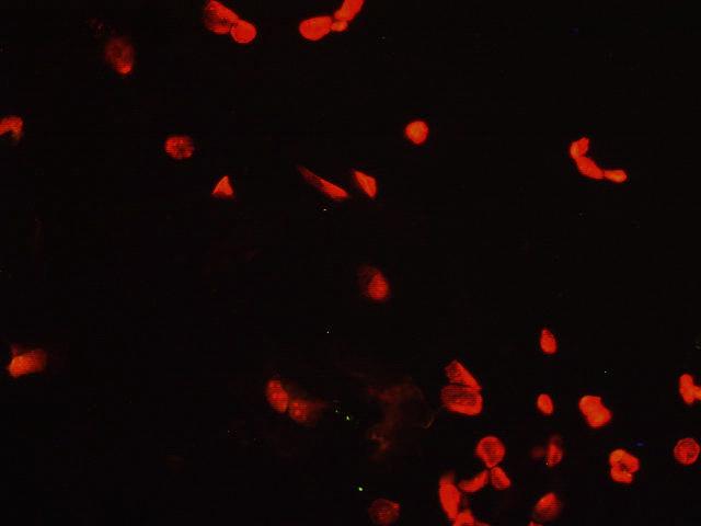 Apoptotic cells exhibited yellow-green fluorescence, while normal