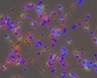 After incubation, macrophages were fluorescently labeled with Hoechst 3343 (nuclei, blue