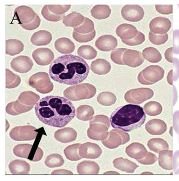 Neutrophils Synthesized from myeloid precursor cells in the bone marrow - 200 billion/day; half-life approx 8 hours (longer during inflammation) Production