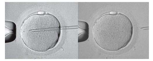 INTRODUCTION ICSI: Palermo reported the first case in 1992 Just 1 sperm is enough to fertilize
