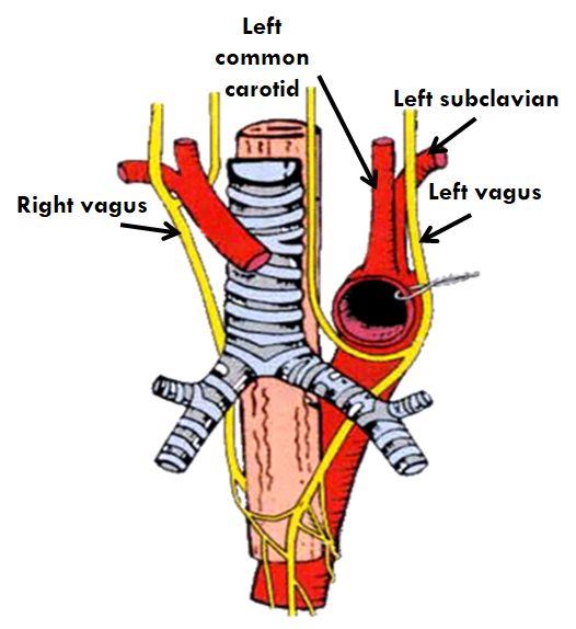 The left vagus descends between left common carotid & left subclavian arteries, forms the anterior esophageal plexus & continues in abdomen as anterior gastric nerve.
