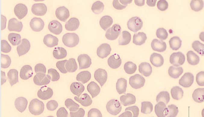 Metamyelocytes Myelocytes Promyelocytes Blasts Nucleated red blood