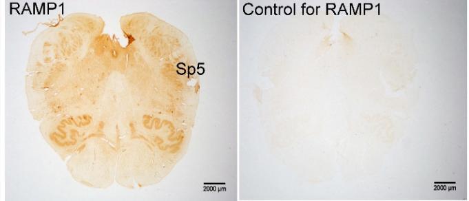 CTR + RAMP1 are expressed in human brainstem including the spinal trigeminal nucleus (Sp5)