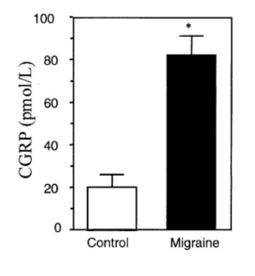 CGRP in headache disorders CGRP is found in sensory neurons of the face and head (trigeminal nerve), brain CGRP content is higher in the blood during a migraine attack CGRP