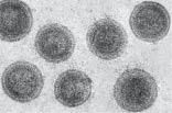 6 (a) What term is used to describe disease-causing organisms? 11.. [1] (b) Fig. 6.1 shows some virus particles that cause the transmissible disease, infl uenza. Fig. 6.1 Suggest how the virus particles that cause infl uenza are transmitted from one person to another.