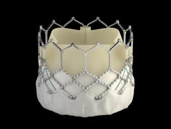 Transfemoral TAVR Devices Iterative Device Design Iterative devices have been designed to mitigate