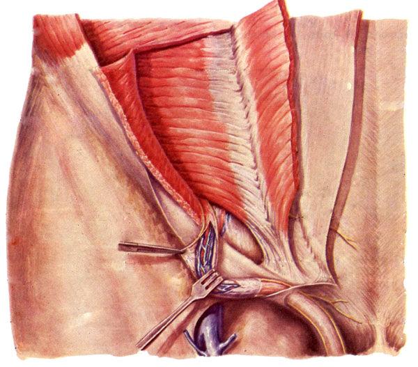 pampiniform plexus of vein nervous plexus lymphatic vessels remnants of vaginal