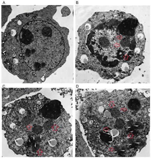 Cells were treated with (A) 0, (B) 20, (C) 80 and (D) 300 µm ferruginol and examined using TEM at x400 magnification.