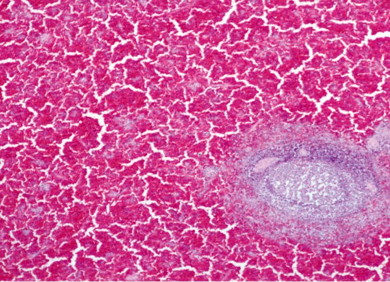 Histology: Red pulp dilated and