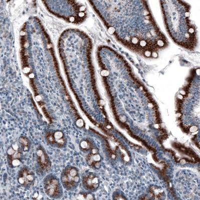 36770] - Staining of human small intestine shows strong granular cytoplasmic positivity