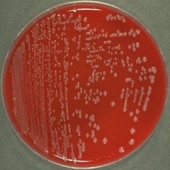 with other enteric bacteria (Hafnia alvei, P.