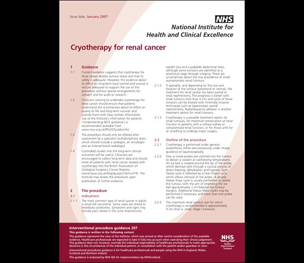 Cryotherapy for renal cancers - NICE interventional procedures guidance 207 (2007) [Current guidance] Current evidence suggests that cryotherapy for renal cancer ablates tumour tissue and that its