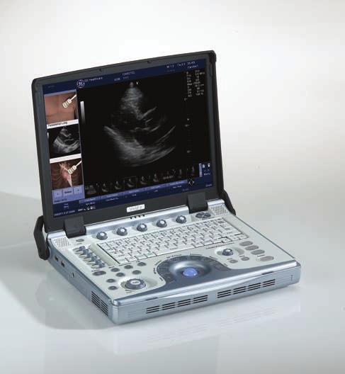 esmarttrainer module An esmarttrainer module is a great reference tool, allowing the user quick access to ultrasound illustrations, views, and brief descriptions during an ultrasound exam.