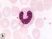 opportunistic infections, cancer Normal Values 60%-80% of total WBC count (1800-7700 cells/mm3) Majority stored in marrow