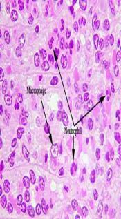 cell types as the need arises Monocytes Greek: big eaters Makros large + phagein eat