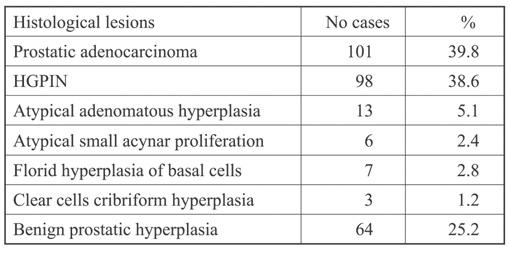 them had HGPIN (38.6%, average age 69.5 years). The 28 patients with PA (101) had concomitant HGPIN (27.7%). Table 1. Histological lesions from needle biopsies of prostate in 254 patients.