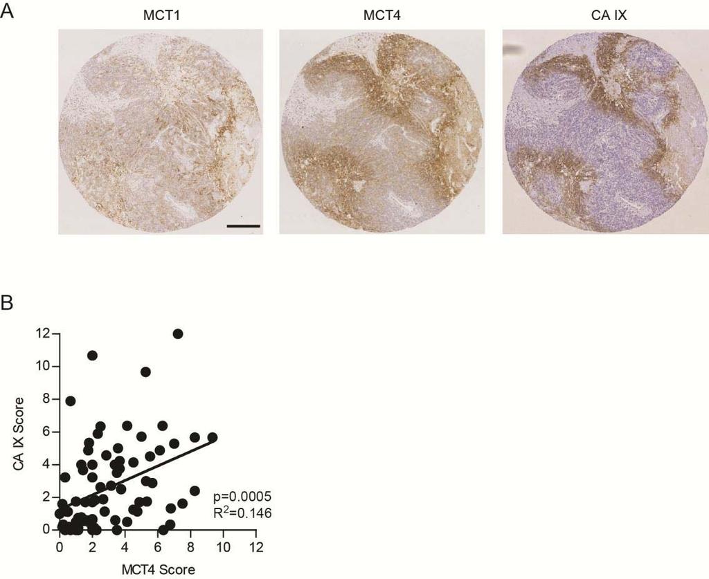 Supplemental Figure 10 Positive correlation between MCT4 and CA IX staining.