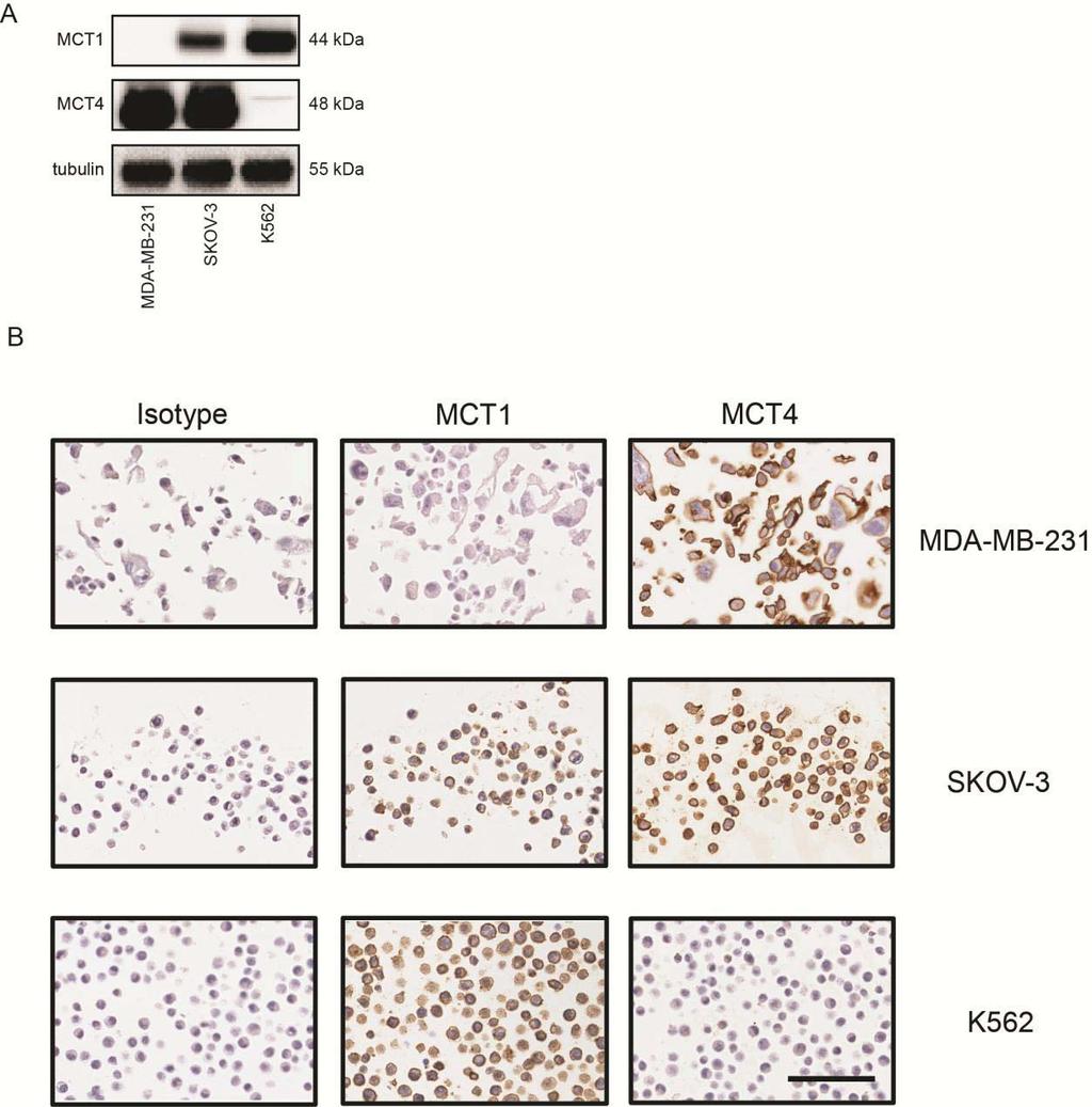 Supplemental Figure 7 Validation of MCT1 and MCT4 IHC staining. (A) MDA- MB-231, SKOV3 and K562 cells were chosen as cell lines with varying MCT1 and MCT4 expression by western blotting.