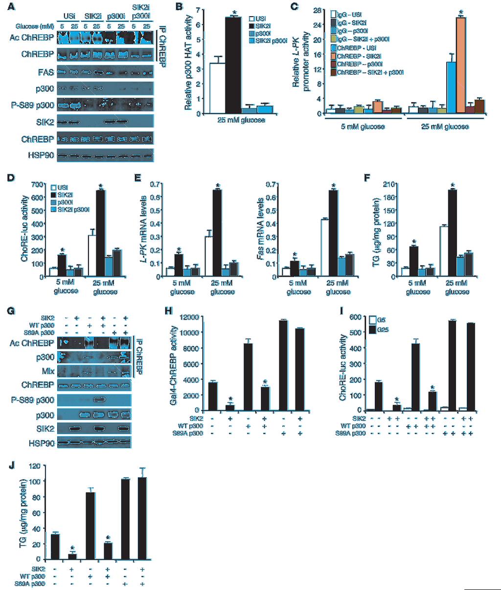 Figure 5 SIK2 regulates ChREBP transactivation activity through p300 phosphorylation.
