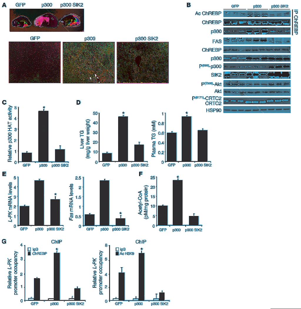 Figure 6 p300 overexpression impairs lipid homeostasis and leads to hepatic steatosis.