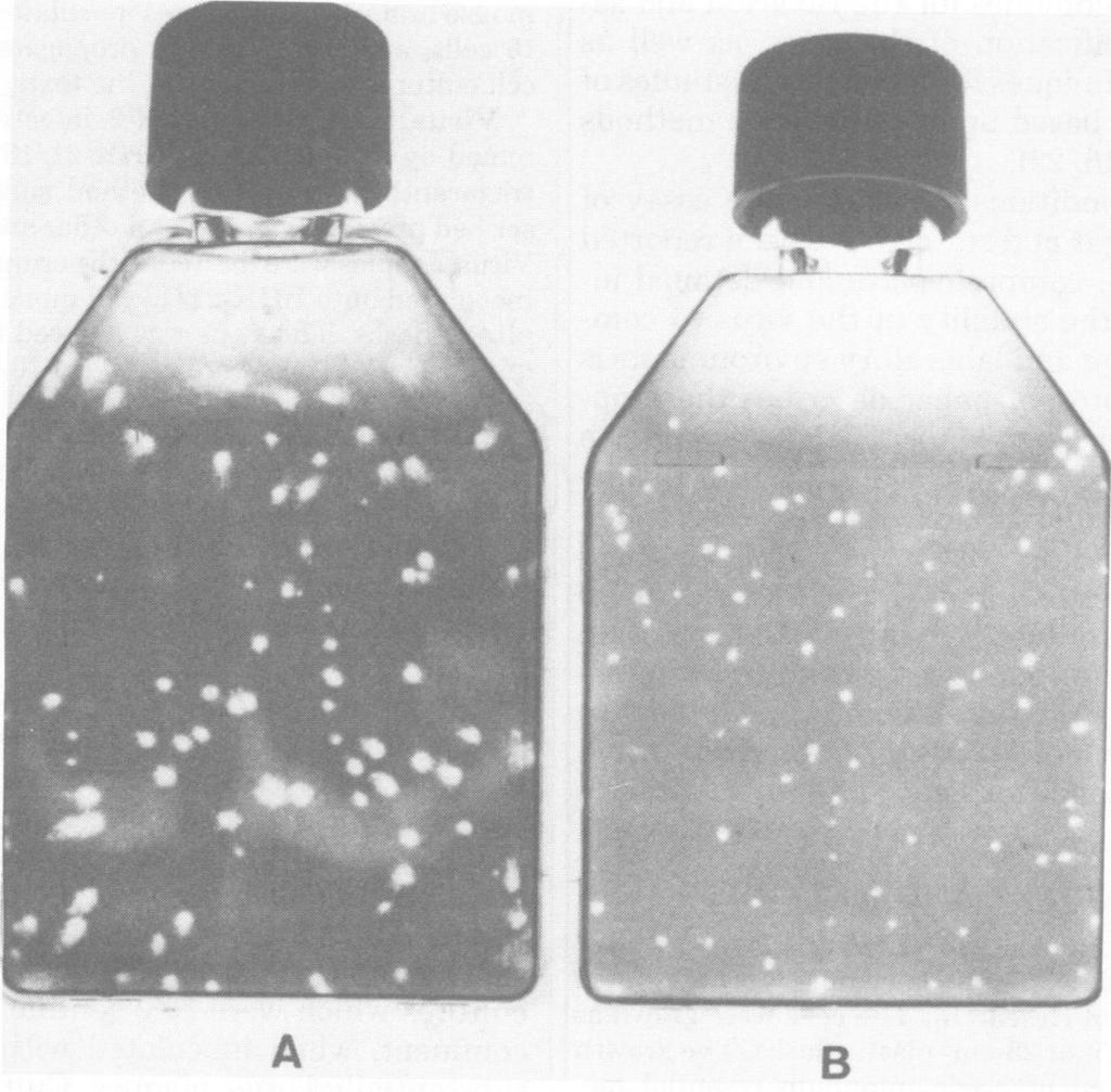 236 MANNING AND COLLINS mm (Fig. IA), whereas cultures confluent at inoculation produced plaques ranging from 0.5 to 1.5 mm in diameter (Fig. 1B).