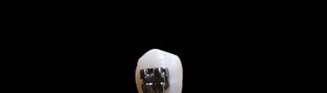 belief that the strength of bracket-tooth interface within the range 3 7 МРа is satisfactory for the clinical work of an orthodontist [3 5], while other authors state a somewhat bigger range of