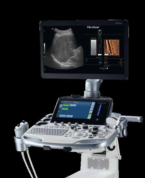 Part of the XDclear Family LOGIQ S8 XDclear 2.0 Simply Amazing The new LOGIQ S8 XDclear 2.0 is joining the LOGIQ XDclear Family, the leadership branding in GE General Imaging Ultrasound.