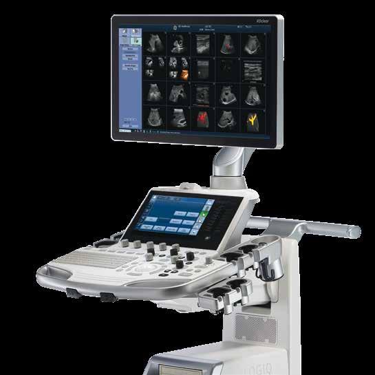 Part of the XDclear Family LOGIQ S7 XDclear Amazing Versatility The LOGIQ S7 XDclear is the latest Release of our Premium ultrasound unit.
