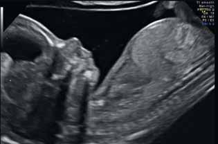Add RealTime 4D imaging technology for gynecological and prenatal applications and expand the clinical utility of ultrasound,