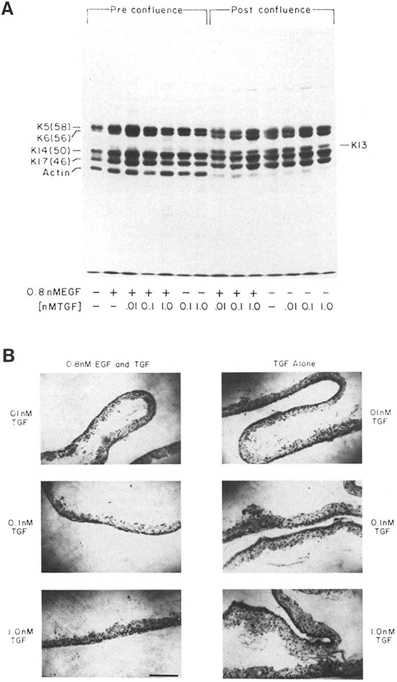 Figure 7. The effects of TGF-13 and EGF on keratin synthesis in submerged epidermal cultures.
