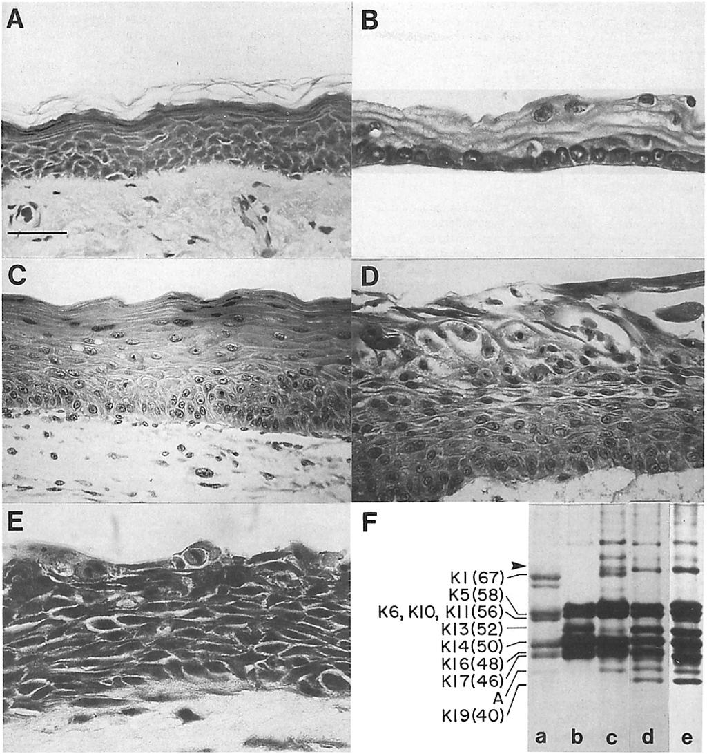 Figure 1. Effects of retinoic acid on morphology and keratin expression in human epidermal cells cultured on collagen rafts.