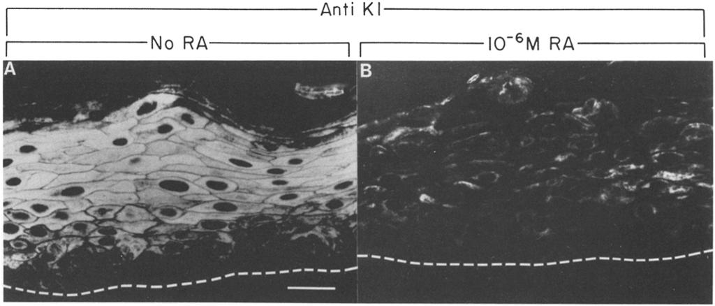 Samples were sectioned (8 Ixm) and subjected to indirect immunofluorescence using an antiserum against K1 (Kim et al., 1984).