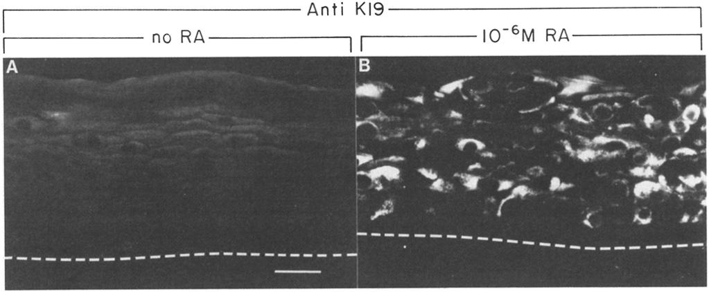 Figure 5. The localization of K19 in retinoid-treated cultures. Epidermal rafts were seeded and floated on medium containing serum and supplements of retinoic acid (RA).