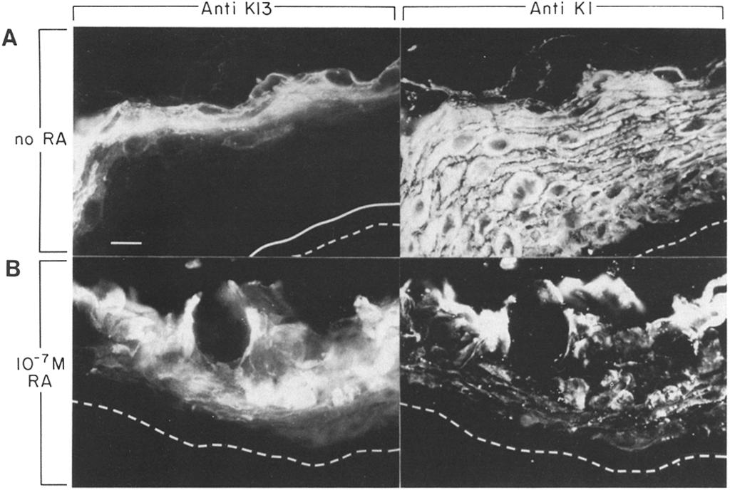 Figure 6. The localization of K13 in retinoid-treated cultures. Epidermal rafts were seeded and floated on medium containing serum and supplements of retinoic acid (RA).