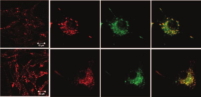 It was first reported that treatment of cultured fibroblasts with anti-bmp antibody that accumulates in late endosomes resulted in a massive accumulation of cholesterol in this compartment.