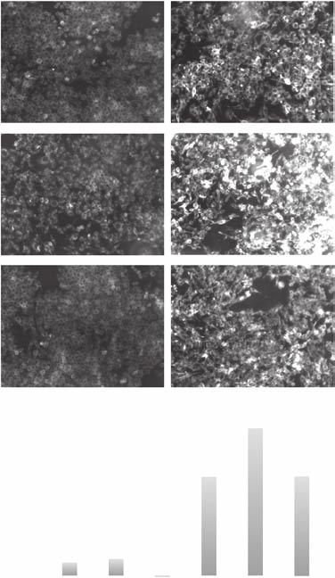 Luquain-Costaz et al BMP and LXR/ABC Pathway in Macrophages 1809 Figure 6. Bis(monoacylglycero)phosphate (BMP) accumulation enhances foam cell formation.
