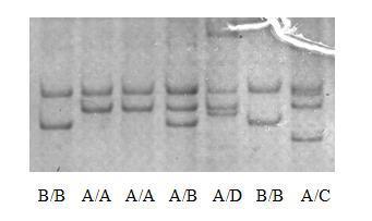 Chapter 4 Results 4.1 Variants of FABP4 The previously identified A 1, B 1, C 1 and D 1 variants of the exon-2-intron 2 region of the FABP4 gene were all identified in the blood samples collected.