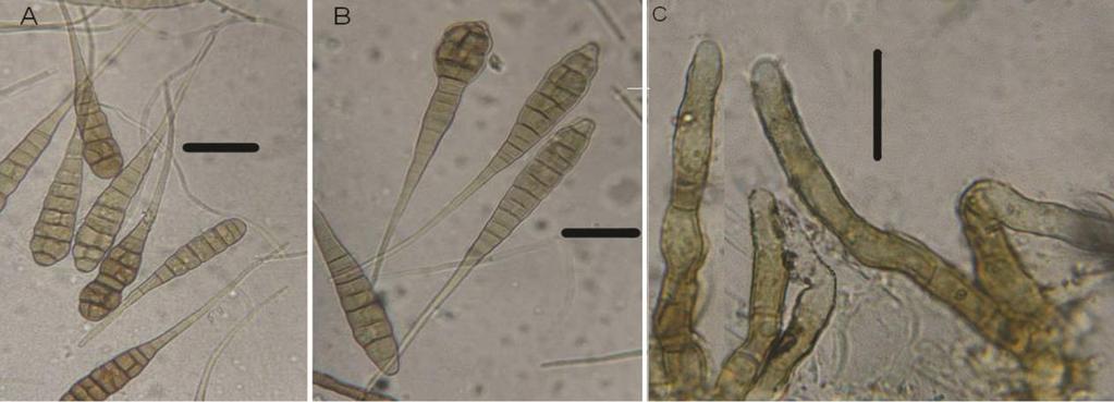 8 Mycologia Iranica - Vol. 1, 2014 Specimen examined: on Calendula officinalis L., Guilan, Rasht, Feb. 22, 2011, V. Taheriyan (933). Pseudocercospora sordida (Sacc.