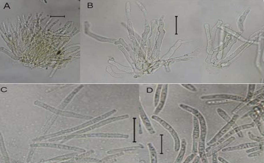 TAHERIYAN ET AL.: New records for anamorphic fungi of Guilan province, Iran 9 Fig. 3. Thedgonia ligustrina: A and B. conidiophores, C and D. conidia, scale bars = 20 μm.