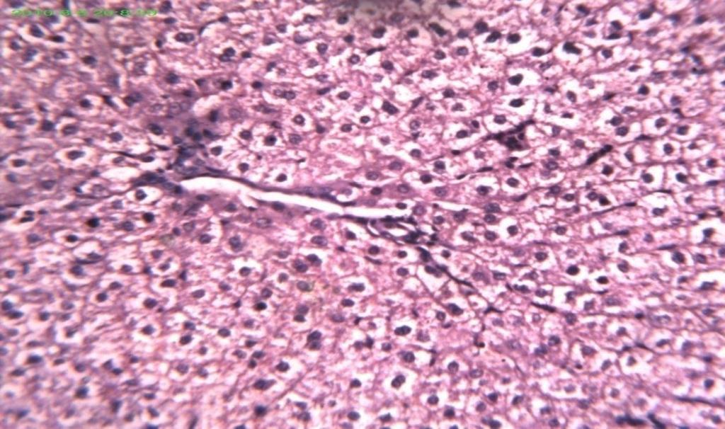in the hepatocytes (A). Congestion and bleeding in the central vein (B) (H&E X400).