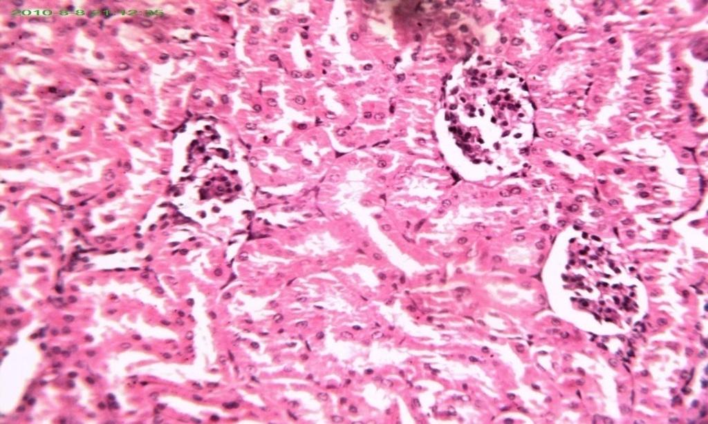 mild histological change of the kidney tubules structure.