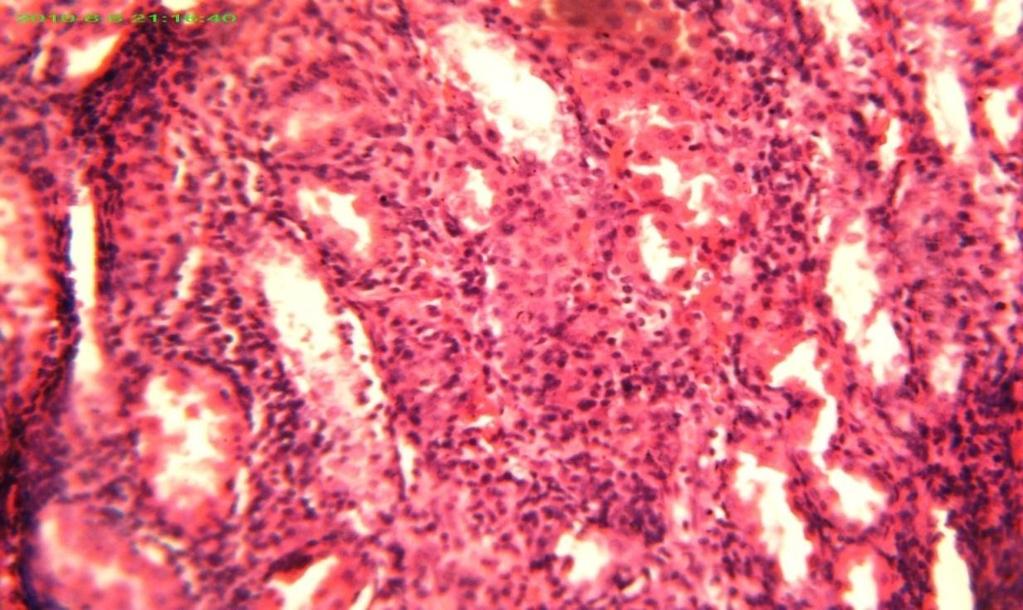 B A Figure (4.23) Kidney section six weeks after experimentation showing rupture of tubules (A).