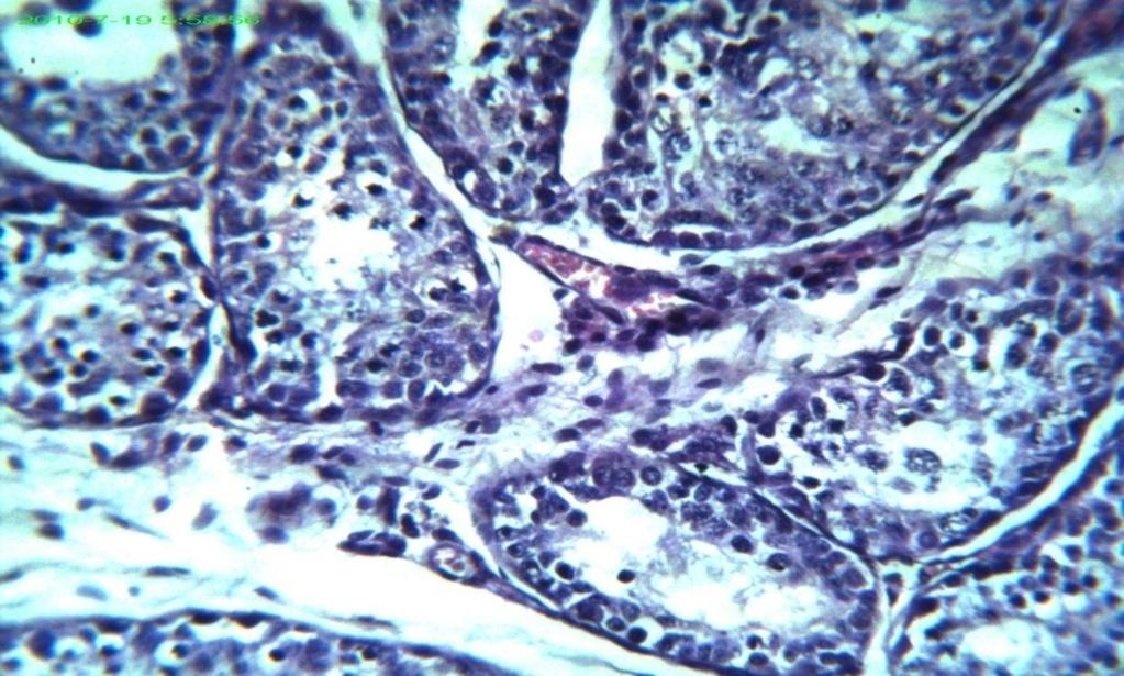 degenerative lesions in the spermatoginal cells (A).
