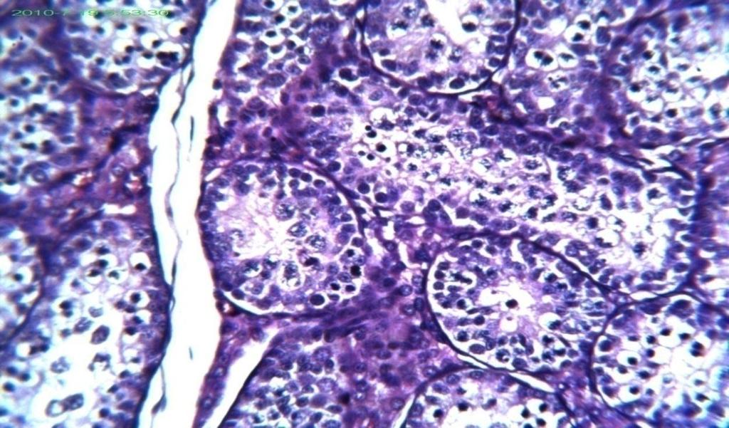 degenerative lesions in the spermatoginal cells (A) (H&E X400).