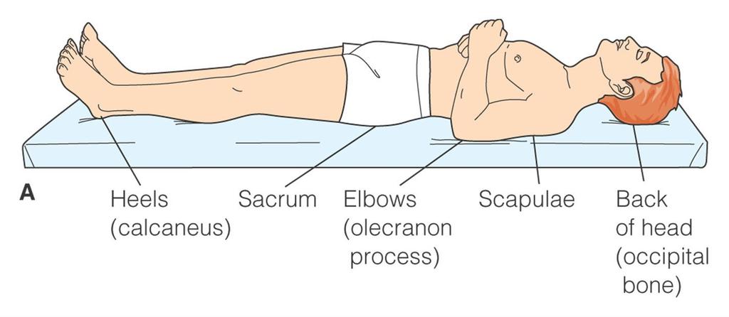 Body pressure areas in Supine