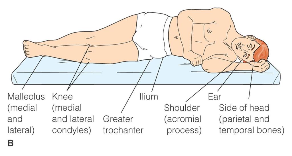 Body pressure areas in Lateral